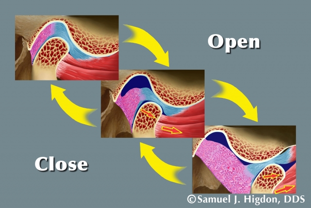 TMJ, TMD and Orofacial Pain